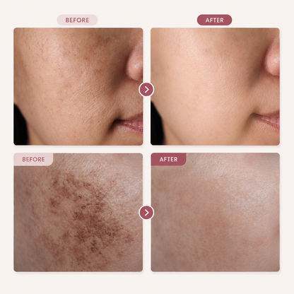 SAESKYN Advanced Arbutin Brightening Cream